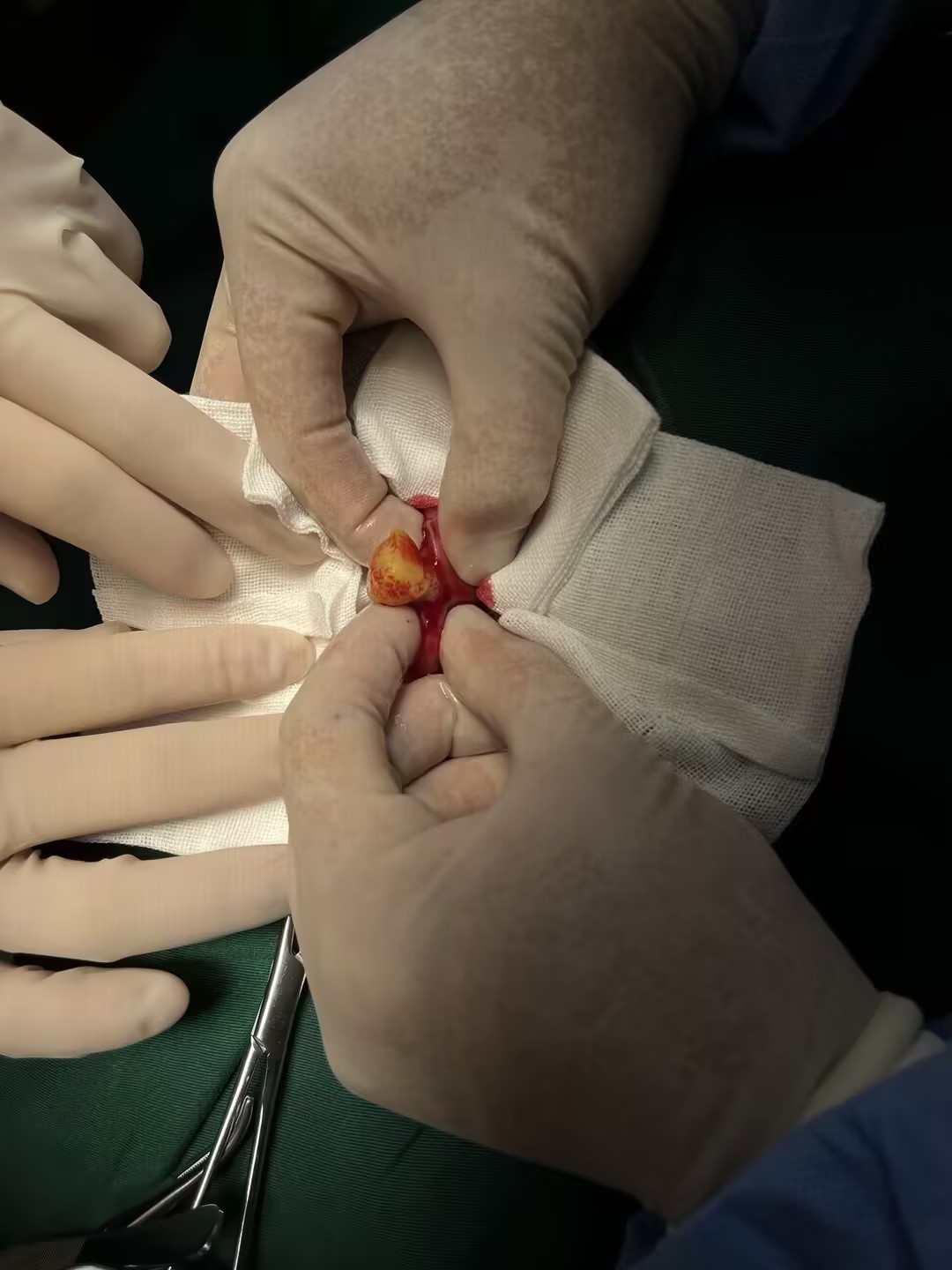 吉娃娃（苹果）消化道异物合并多脏器异常诊疗病例