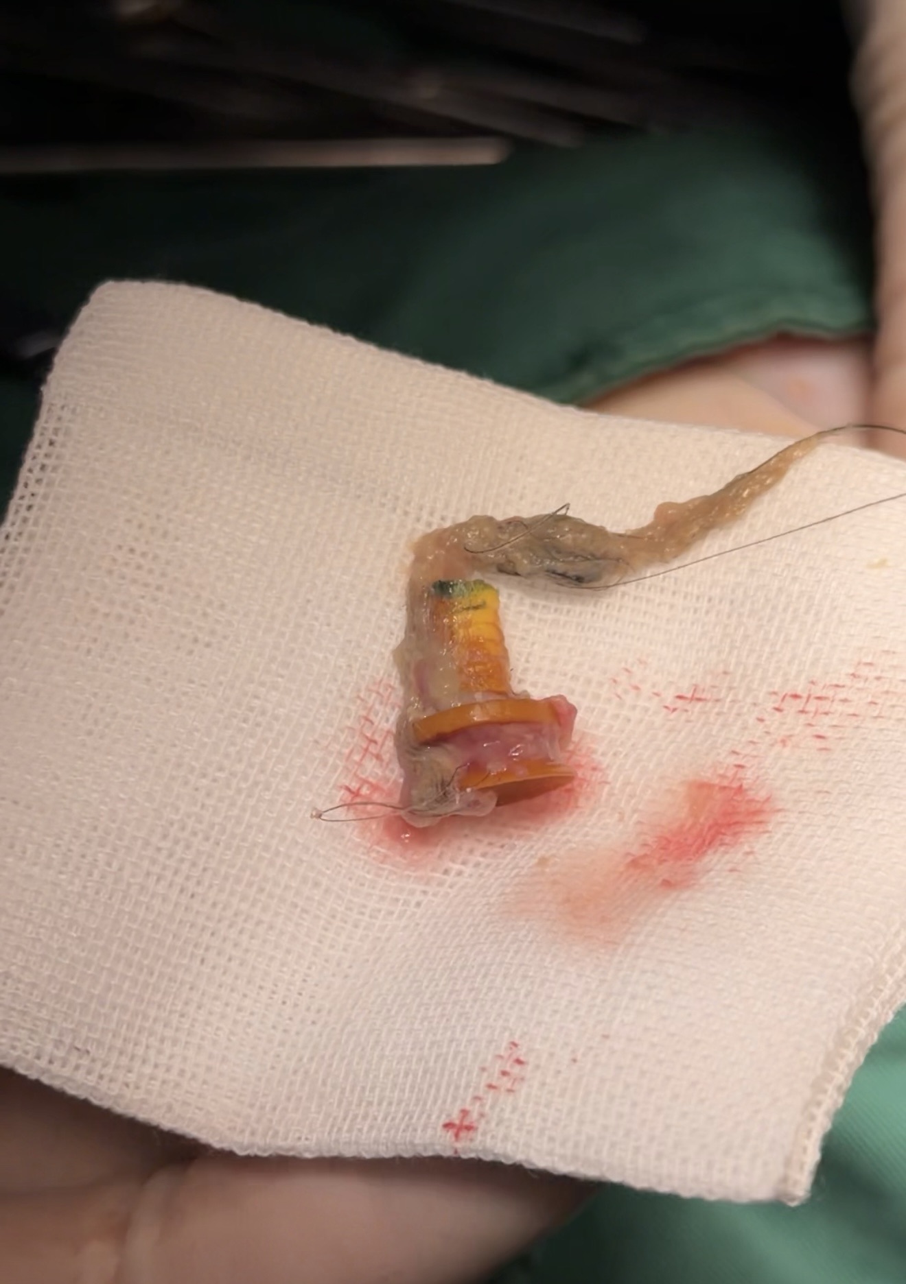 金诚宠物医院 1 岁德文猫肠道异物诊疗过程